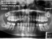 dientes